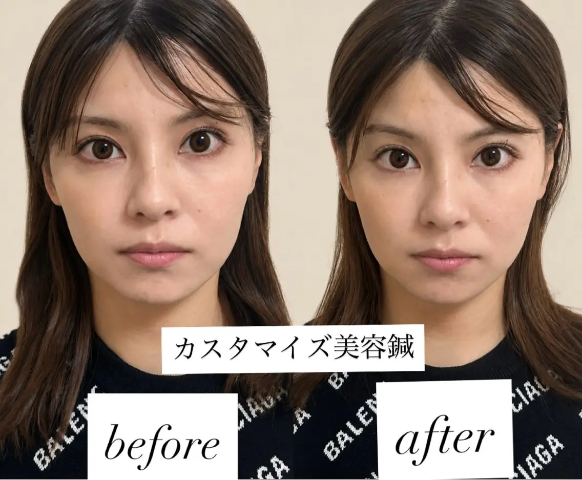 エステ リラク 美容鍼灸サロン mahoroba院長のエステ・リラクイメージ