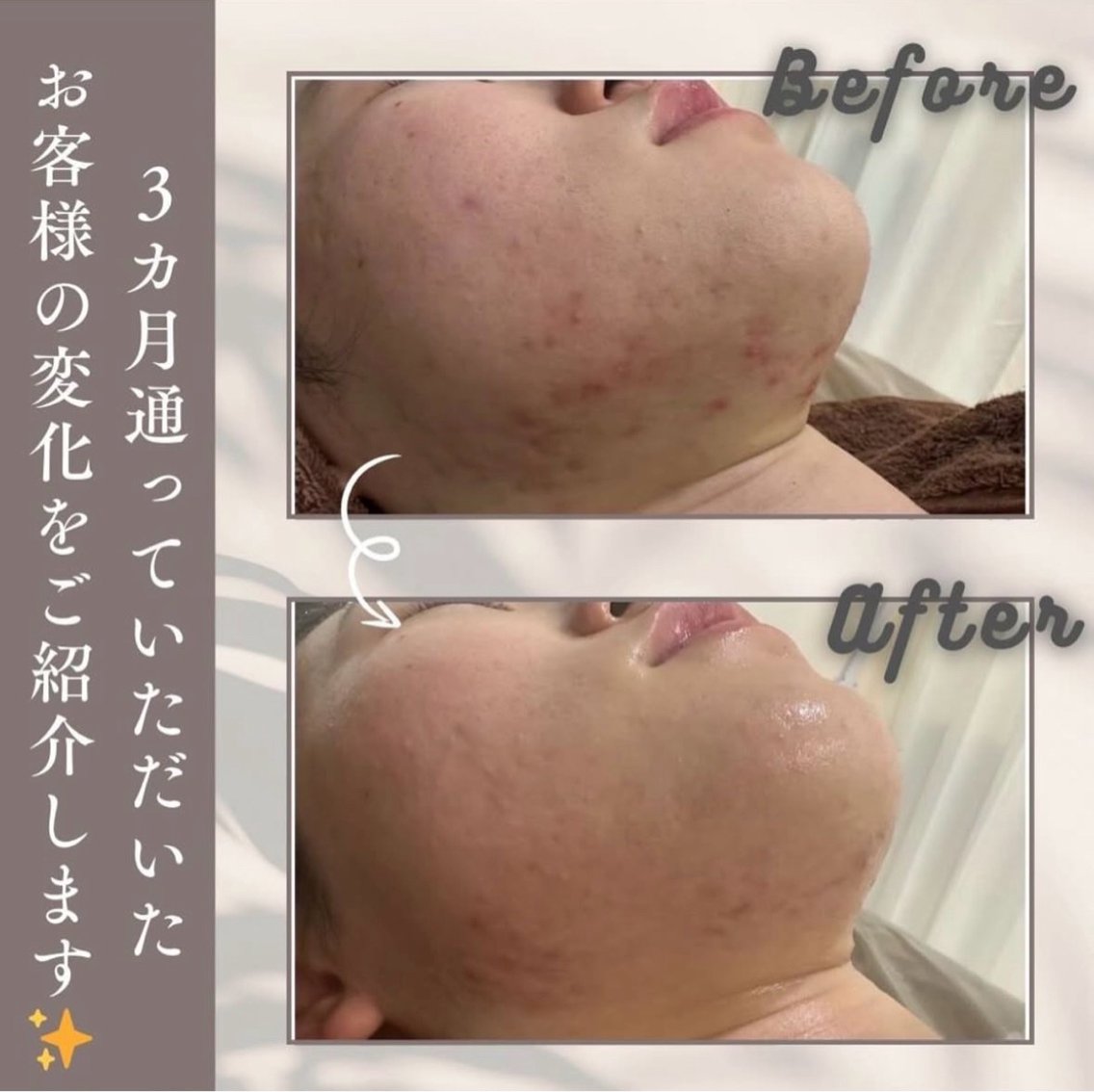 エステ 柏/肌管理専門店/ ⭐️サトウレノン🌟のエステ・リラクイメージ