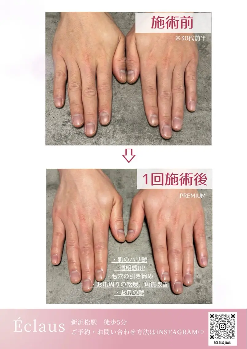 エステ nailsalon Éclausのネイルデザイン