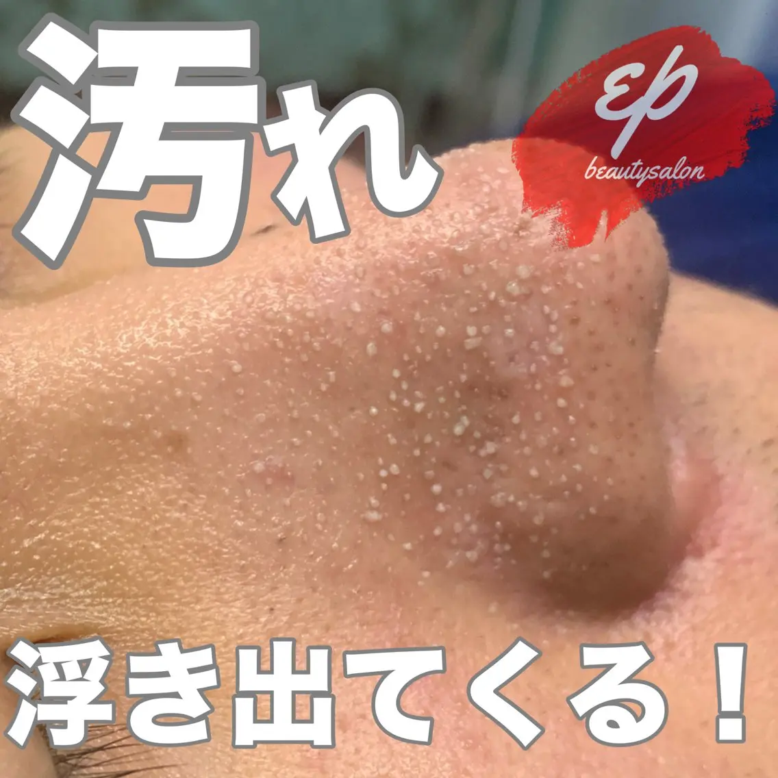 【本気改善エステ】毛穴の開き/いちご鼻🍓/黒ずみ改善しませんか?毛穴が開く生活してませんか?スキンケアの方法教えますの写真