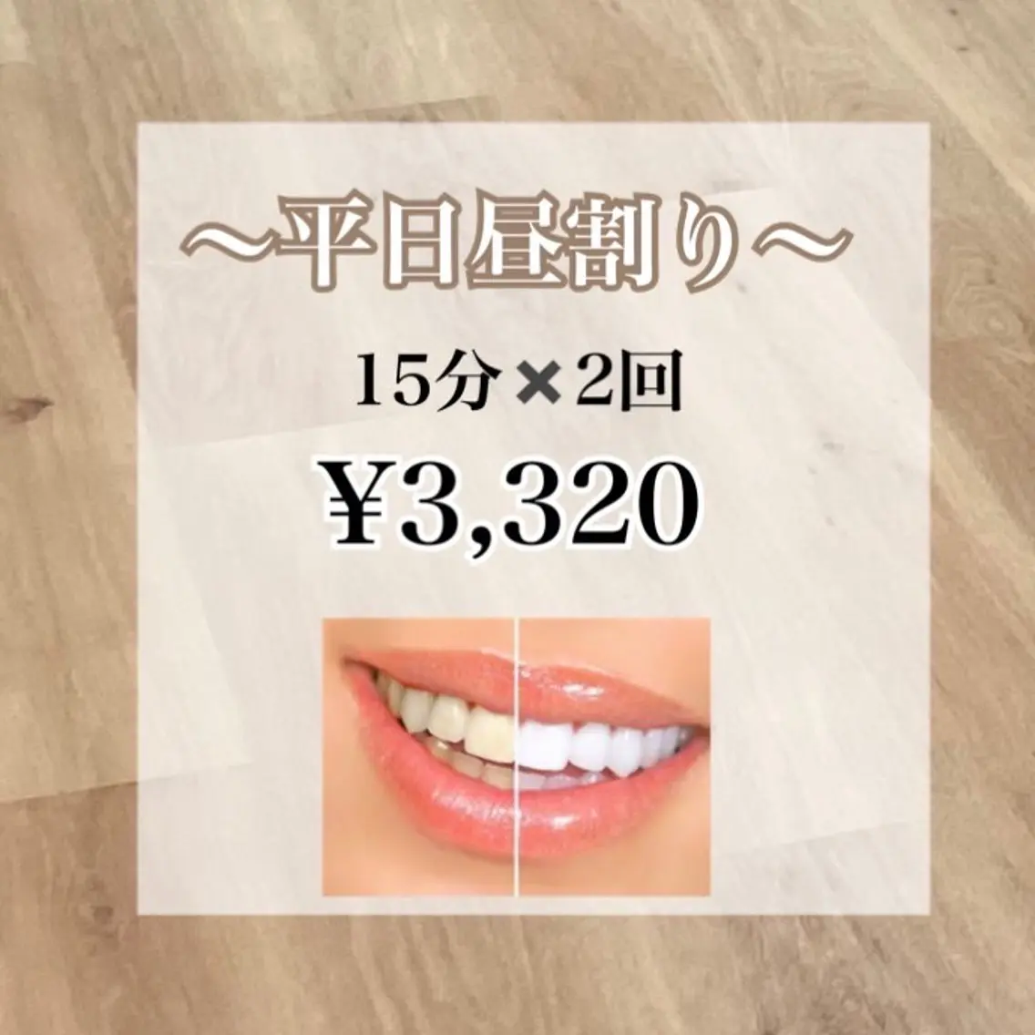 その他 ホワイトニング ショップ 高松瓦町のその他イメージ