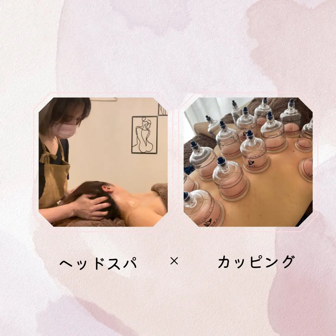イナンナ⌇﻿腸もみ/ カッピング/痩身のエステ・リラクイメージ