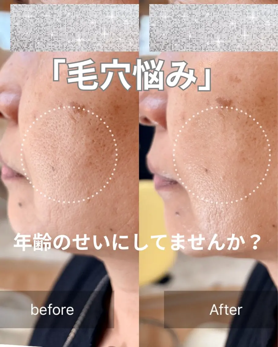 ビフォーアフター写真の写真