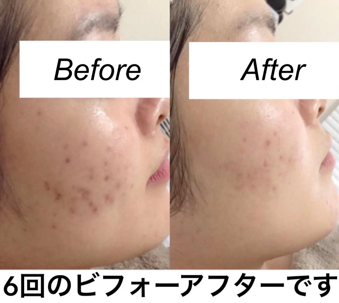 ミディアム カラー パーマ ヘアアレンジ ネイル マツエク・マツパ エステ リラク 都度払い肌質改善 &脱毛Blancheのエステ・リラクイメージ