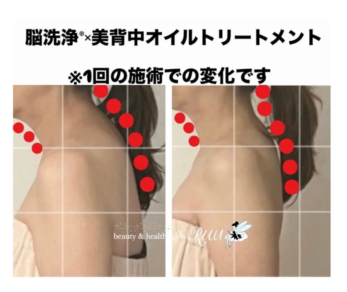 【頭痛、睡眠改善】 salon RUUのエステ・リラクイメージ