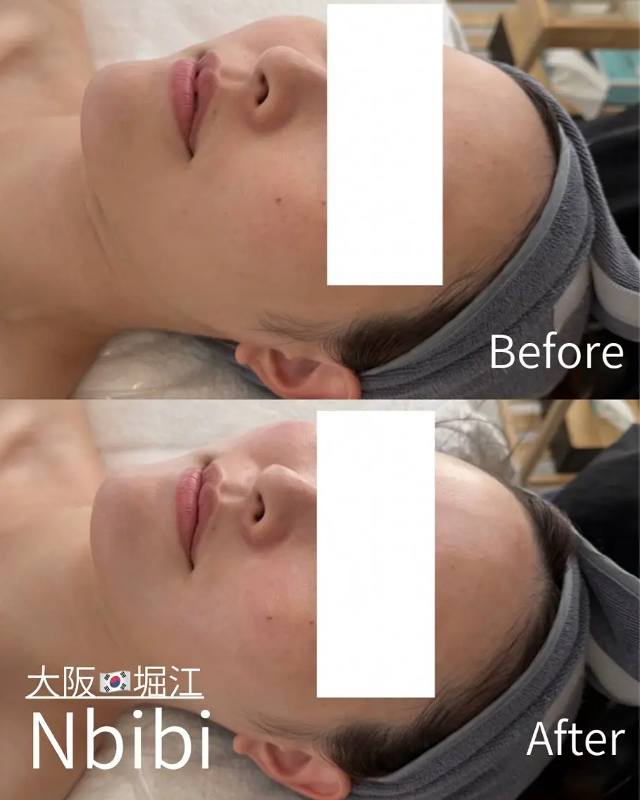 エステ 韓国🇰🇷価格 サロン_Nbibiの眉毛・アイブロウイメージ