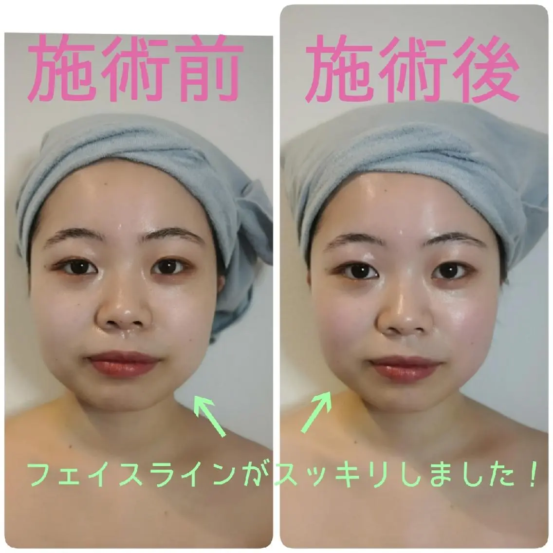 美容鍼/小顔&整体 nano.faceのエステ・リラクイメージ