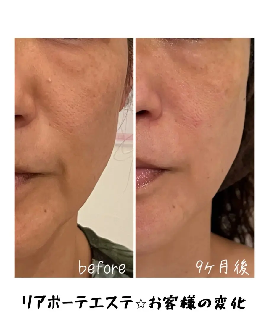 エステ 浜野 恵美のエステ・リラクイメージ