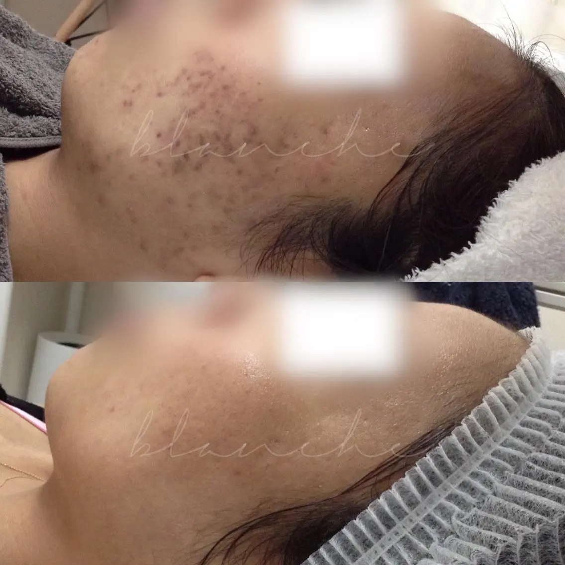 ミディアム カラー パーマ ネイル マツエク・マツパ アイブロウ エステ リラク 都度払い肌質改善 &脱毛Blancheのエステ・リラクイメージ