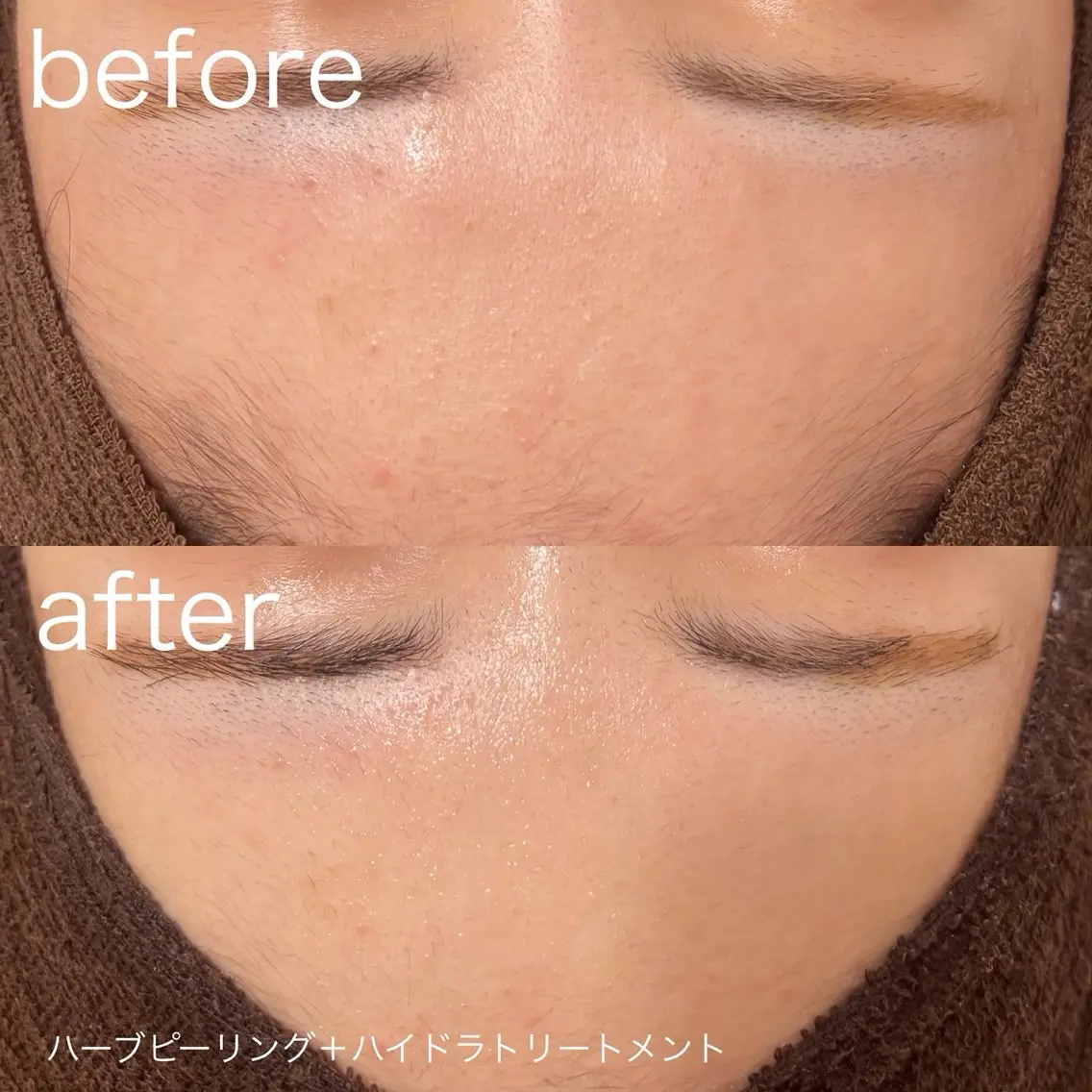 脱毛 lulularico Yuのネイルデザイン