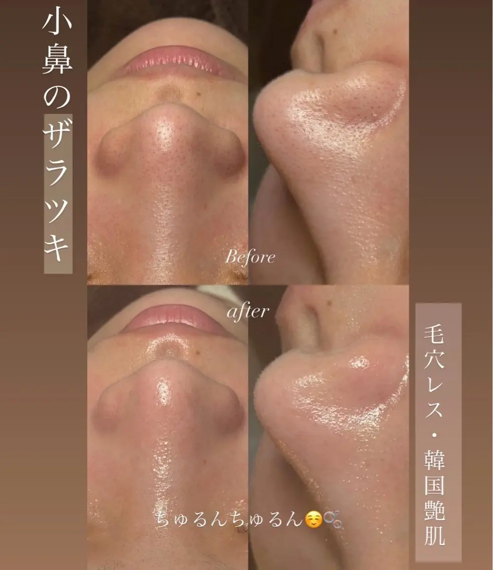 トータルボディケア chouchouのエステ・リラクイメージ
