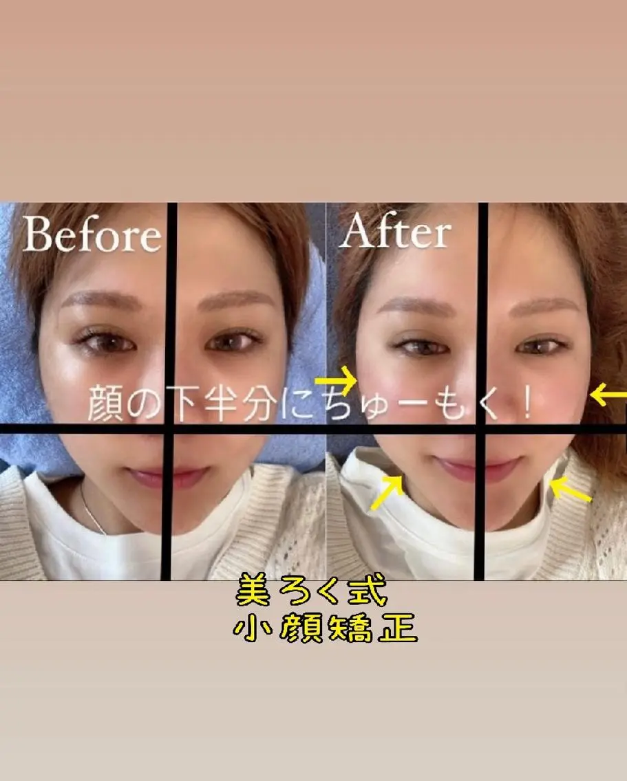 整形級小顔整体&ヘッドスパマッサージ💆♀✨その場で圧倒的変化を実感✨頭蓋骨からアプローチ、浮腫みを流しまるで別人✨の写真