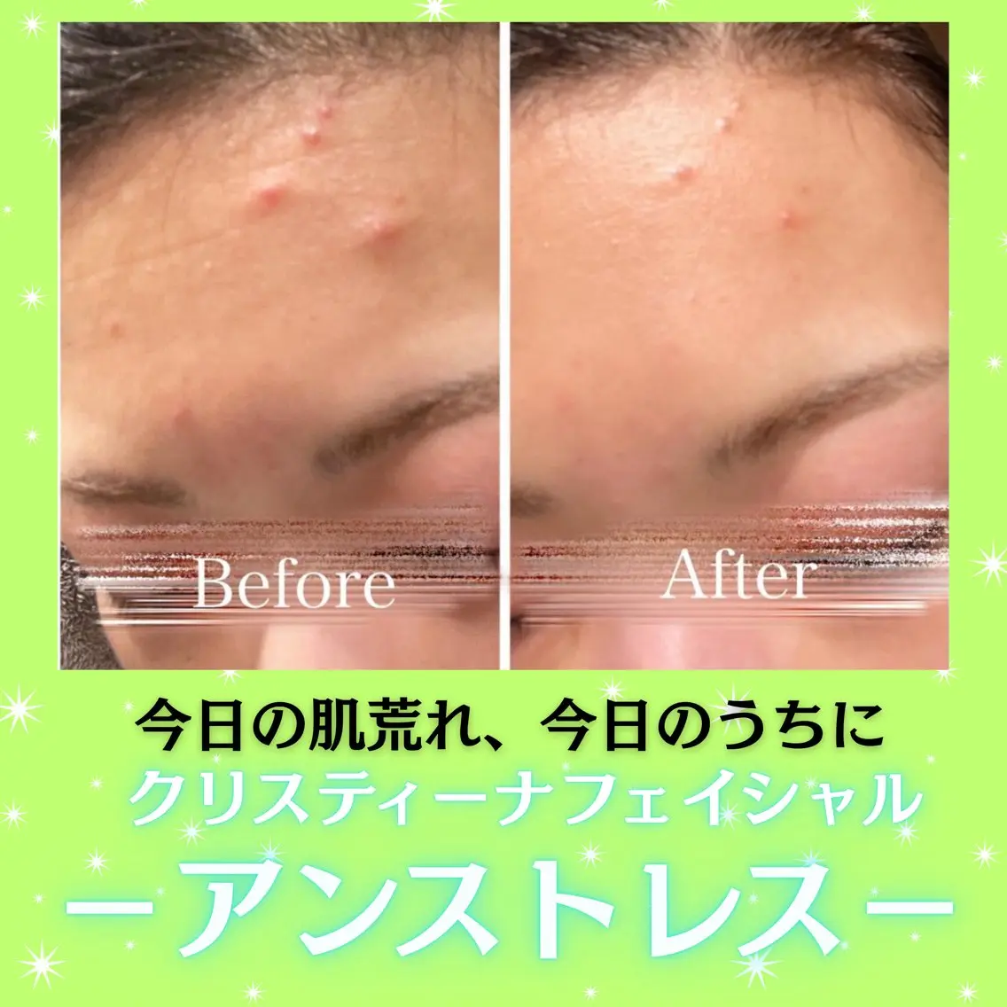 エステ 痩身&美肌サロン 遠藤🍊のエステ・リラクイメージ
