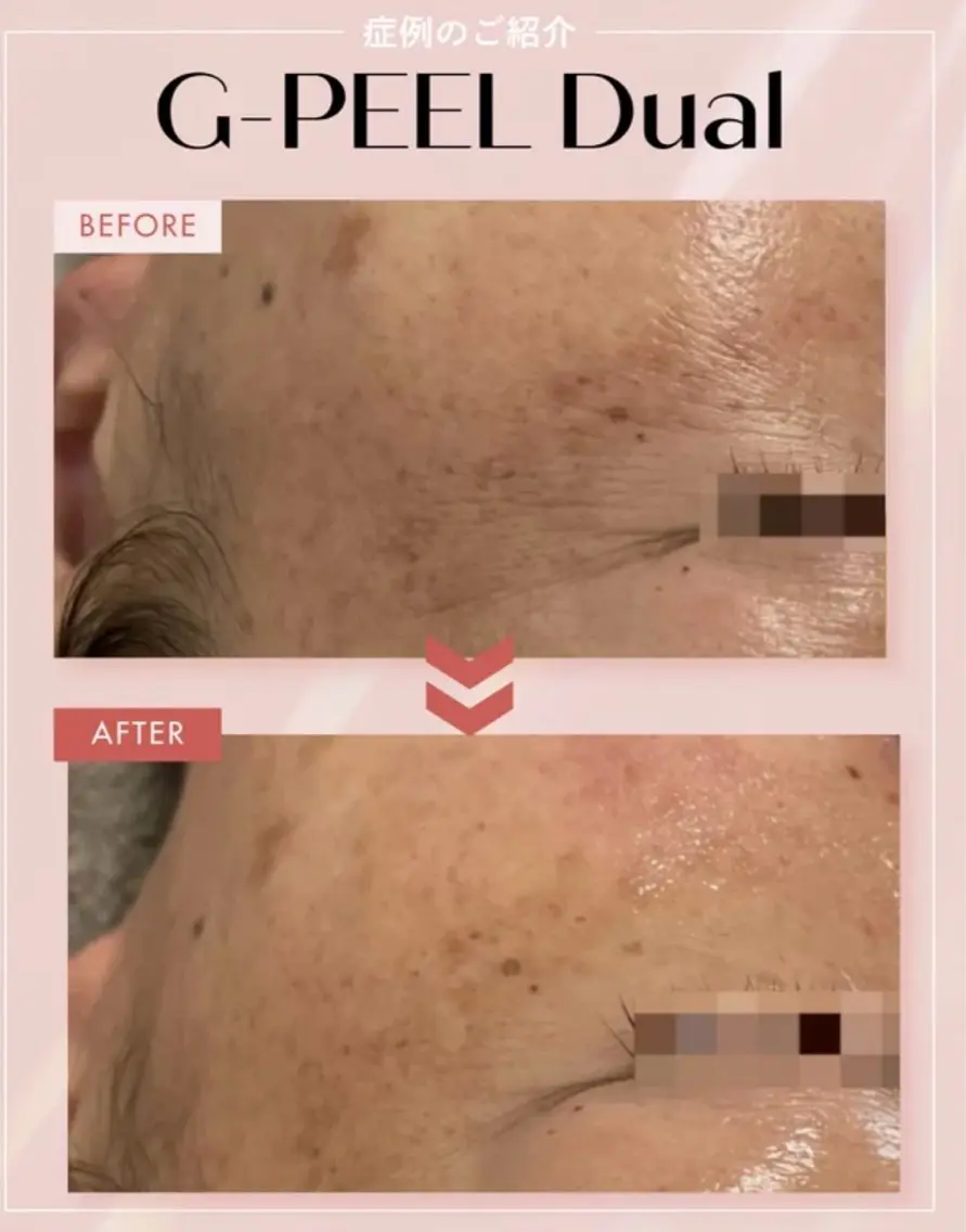 メンズ エステ リラク beauty salonnのエステ・リラクイメージ