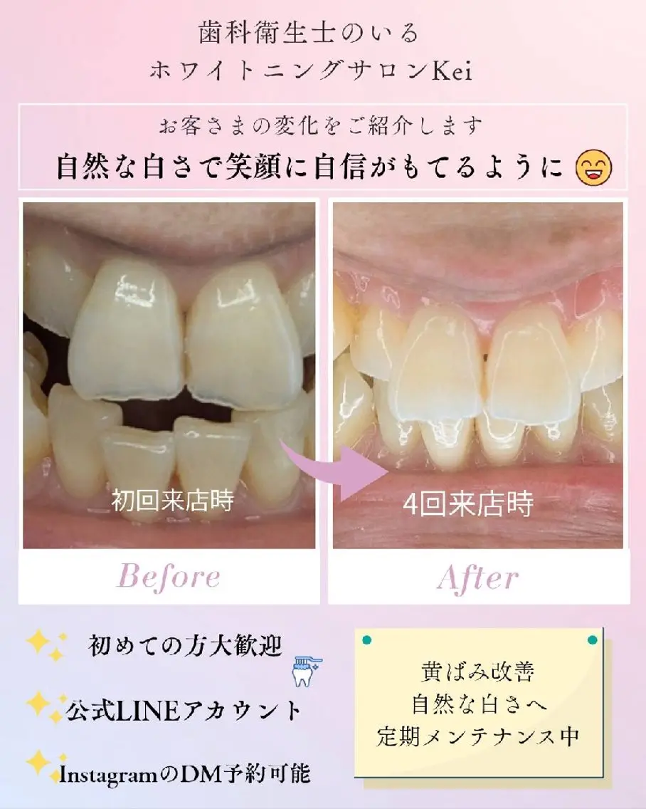 その他 ホワイトニングサロン keiのその他イメージ