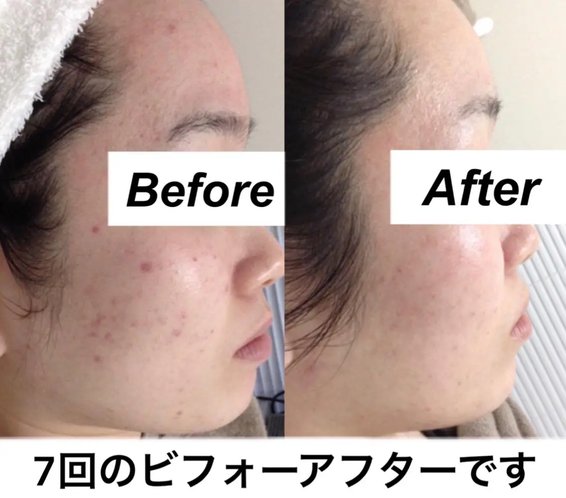 エステ リラク 都度払い肌質改善 &脱毛Blancheのエステ・リラクイメージ