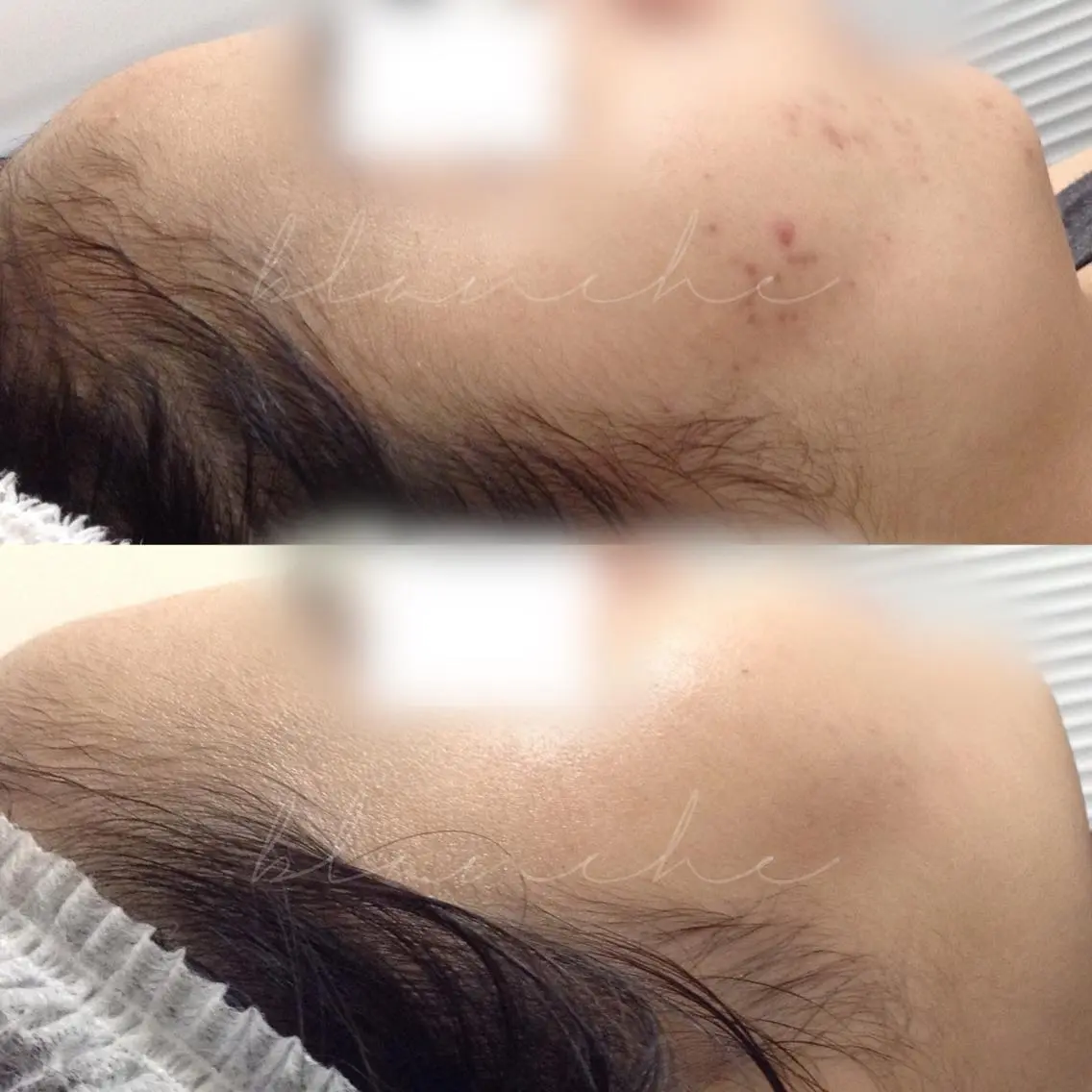 セミロング カラー パーマ ヘアアレンジ ネイル マツエク・マツパ アイブロウ エステ リラク 都度払い肌質改善 &脱毛Blancheのエステ・リラクイメージ