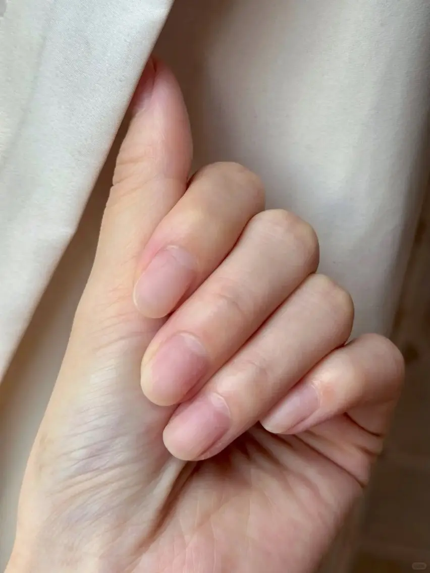 自爪オフのみの写真