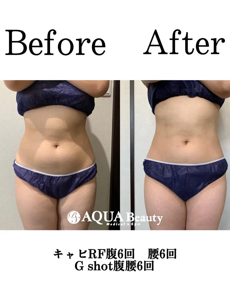 BS AQUA 岡田のエステ・リラクイメージ