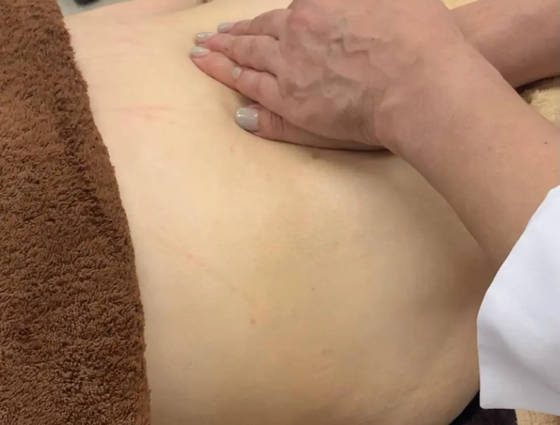 ハーブピーリングお腹の写真