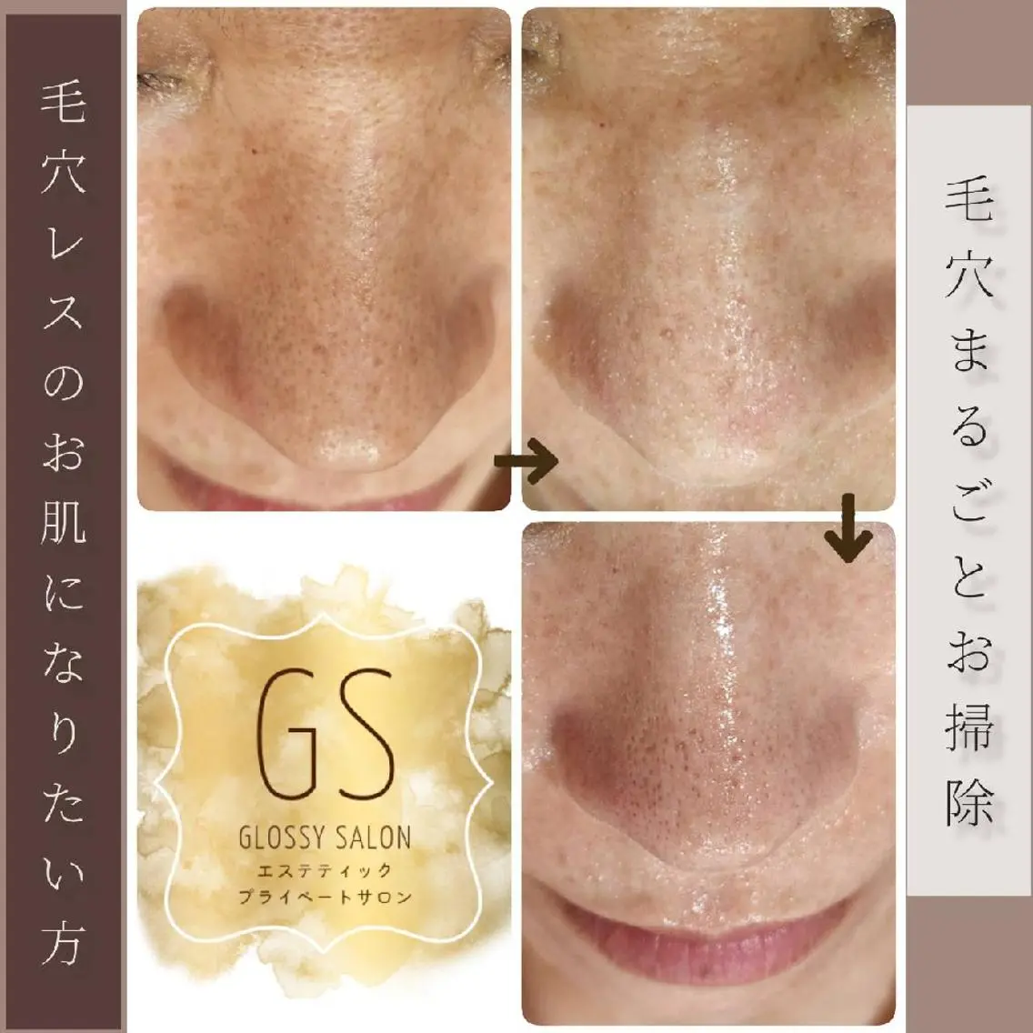 エステ リラク Glossy salonのエステ・リラクイメージ