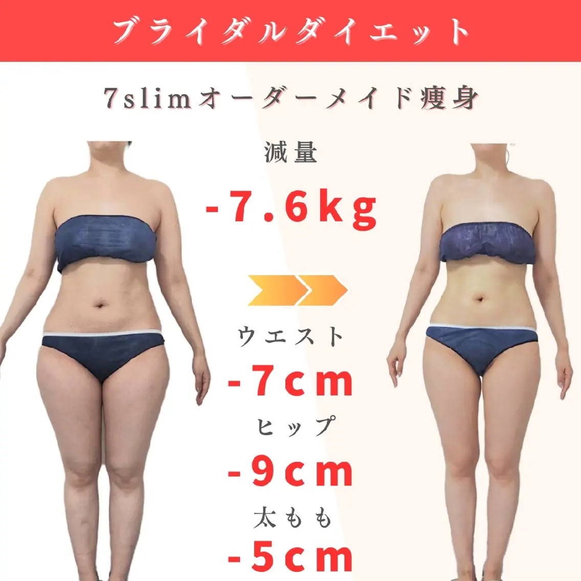痩身小顔専門 アマテ ビューティー.Nのエステ・リラクイメージ
