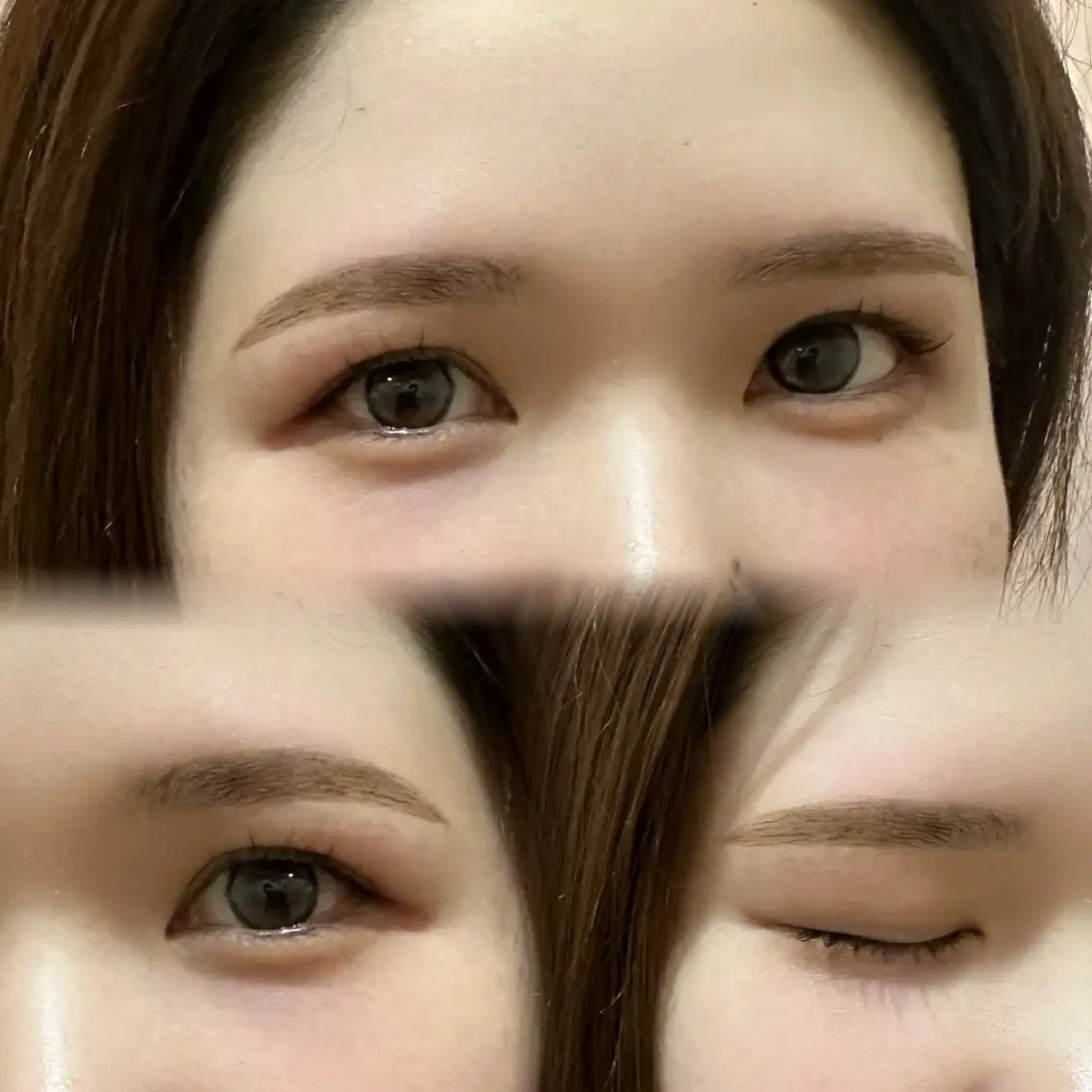 ワックス脱毛の写真