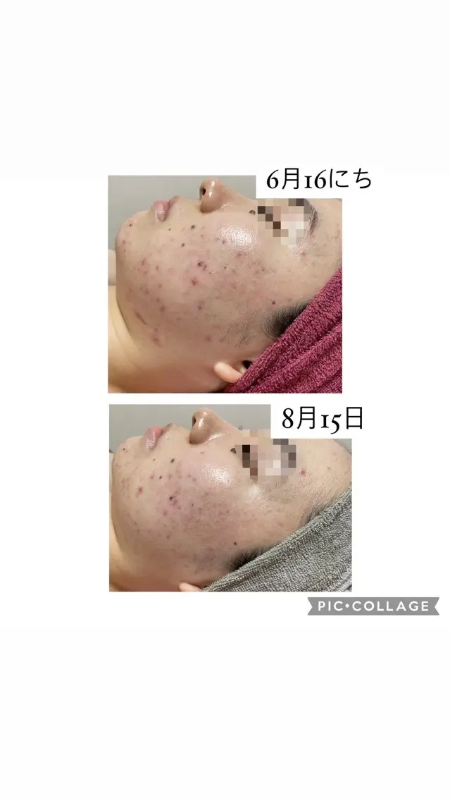 エステ 伊藤 順子のエステ・リラクイメージ