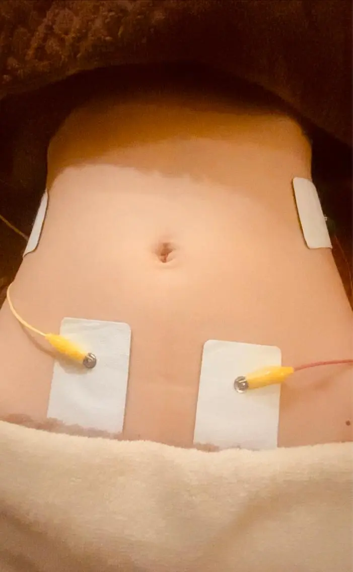 ⚡️EMS 痩身コース⚡️寝ているだけで美ボディの写真