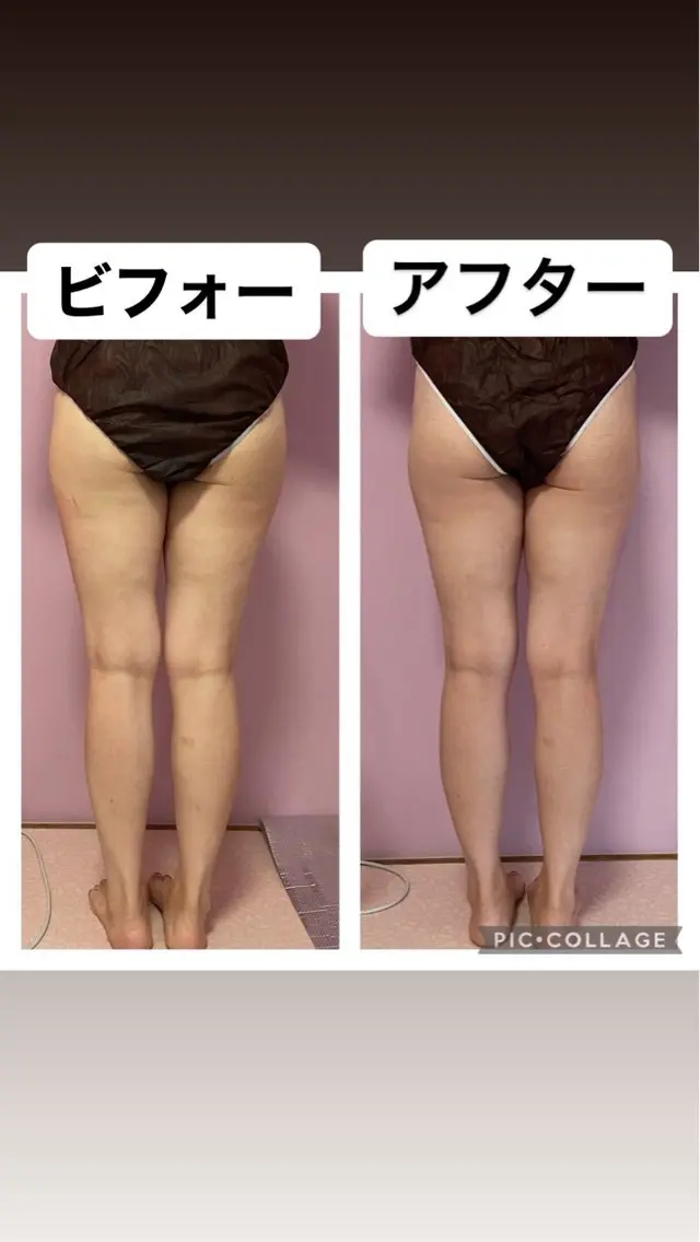 エステ サロンパピヨン 🦋Saeのエステ・リラクイメージ