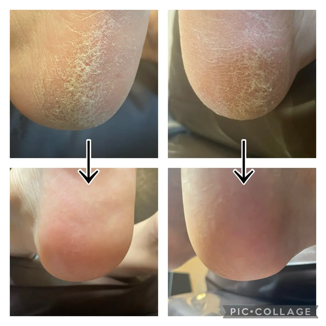 gorella Ａのネイルデザイン