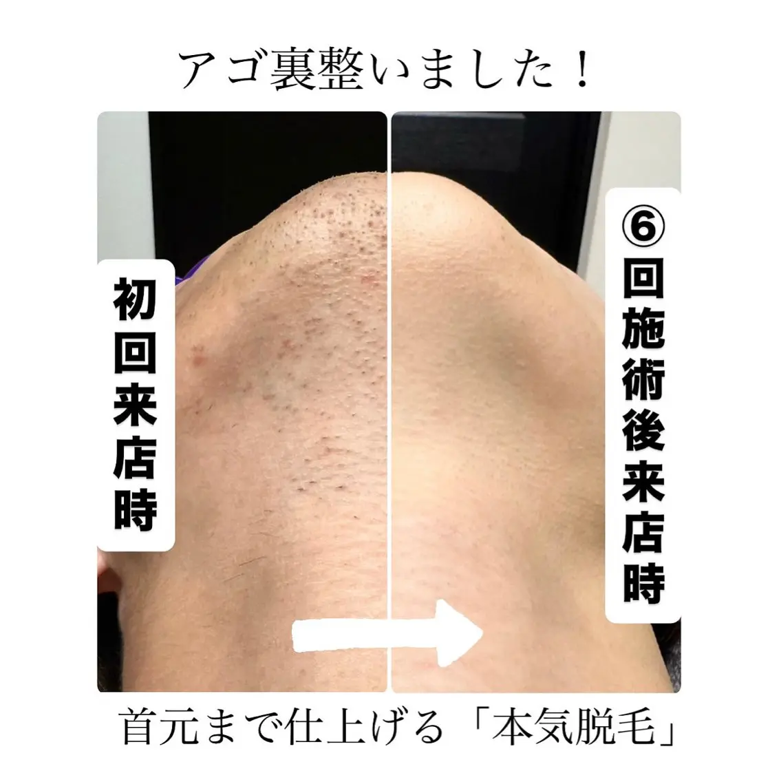 メンズ 脱毛 メンズ脱毛サロン Le falcoのエステ・リラクイメージ