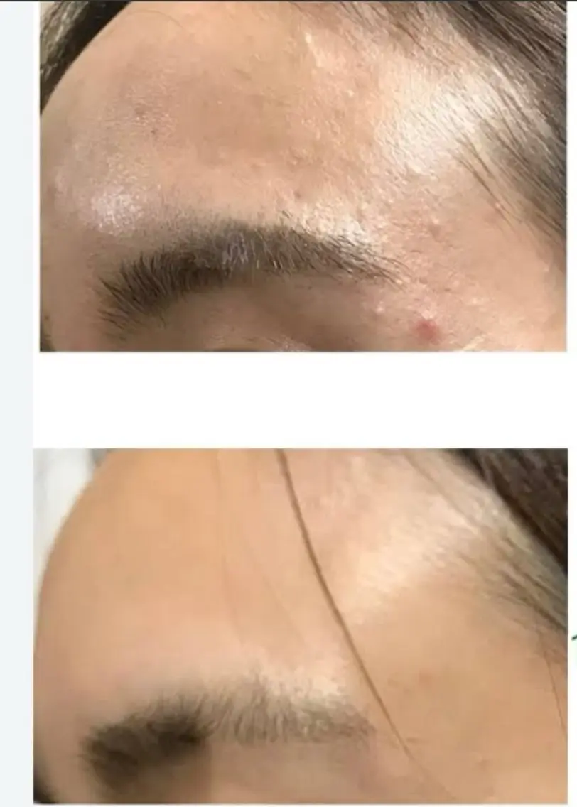 エステ BISIN MEDICALのエステ・リラクイメージ