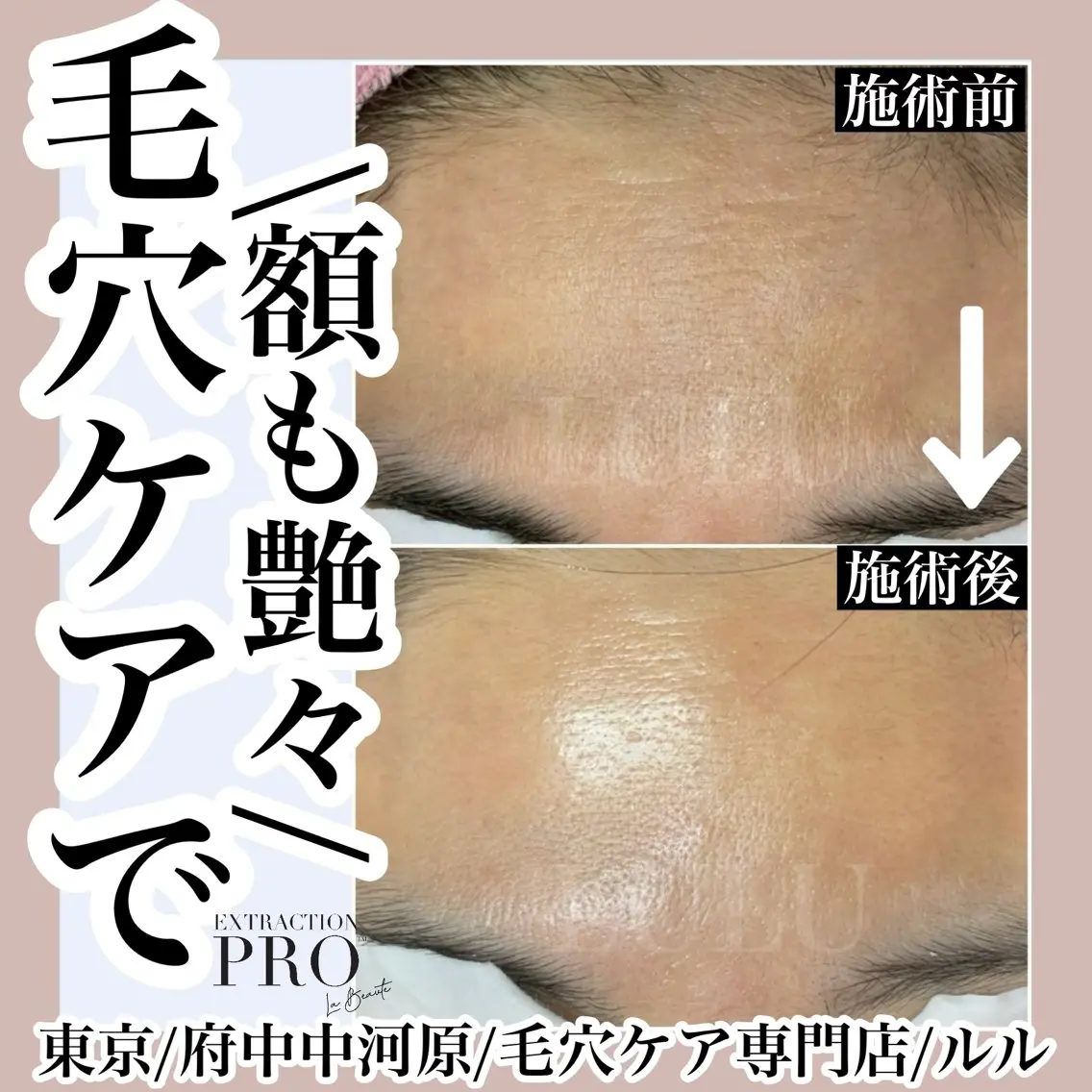 その他 LULU ルルのエステ・リラクイメージ