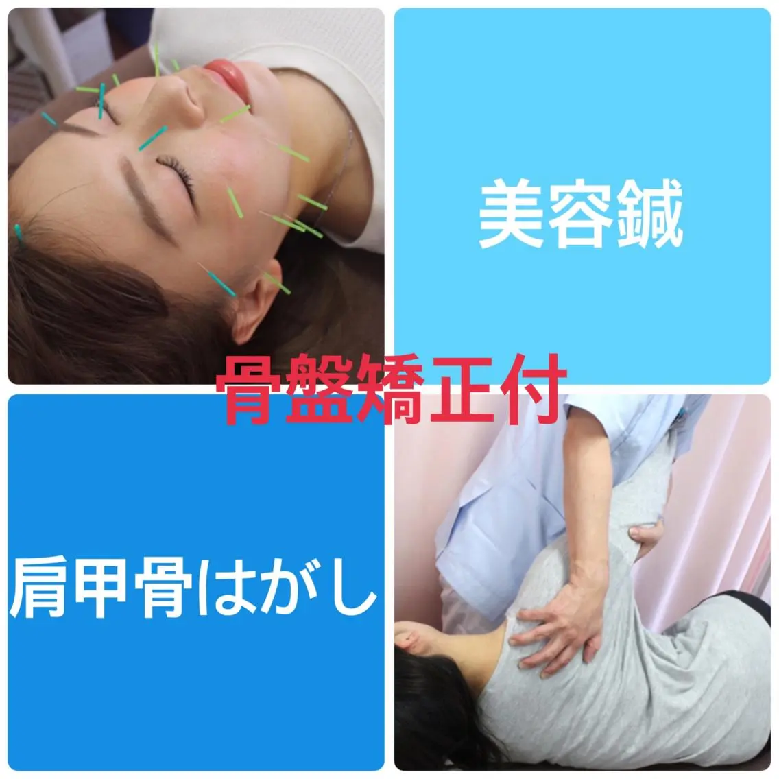骨盤矯正付【美容鍼 + 肩こり姿勢改善整体】カウンセリング付 80分 ¥11,000→¥5,300の写真