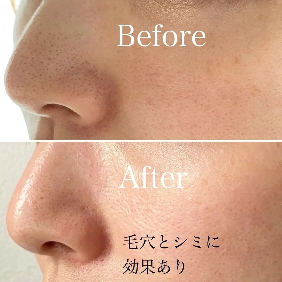 エステ ハーブピーリング専門 毛穴洗浄❤️眉waxのエステ・リラクイメージ
