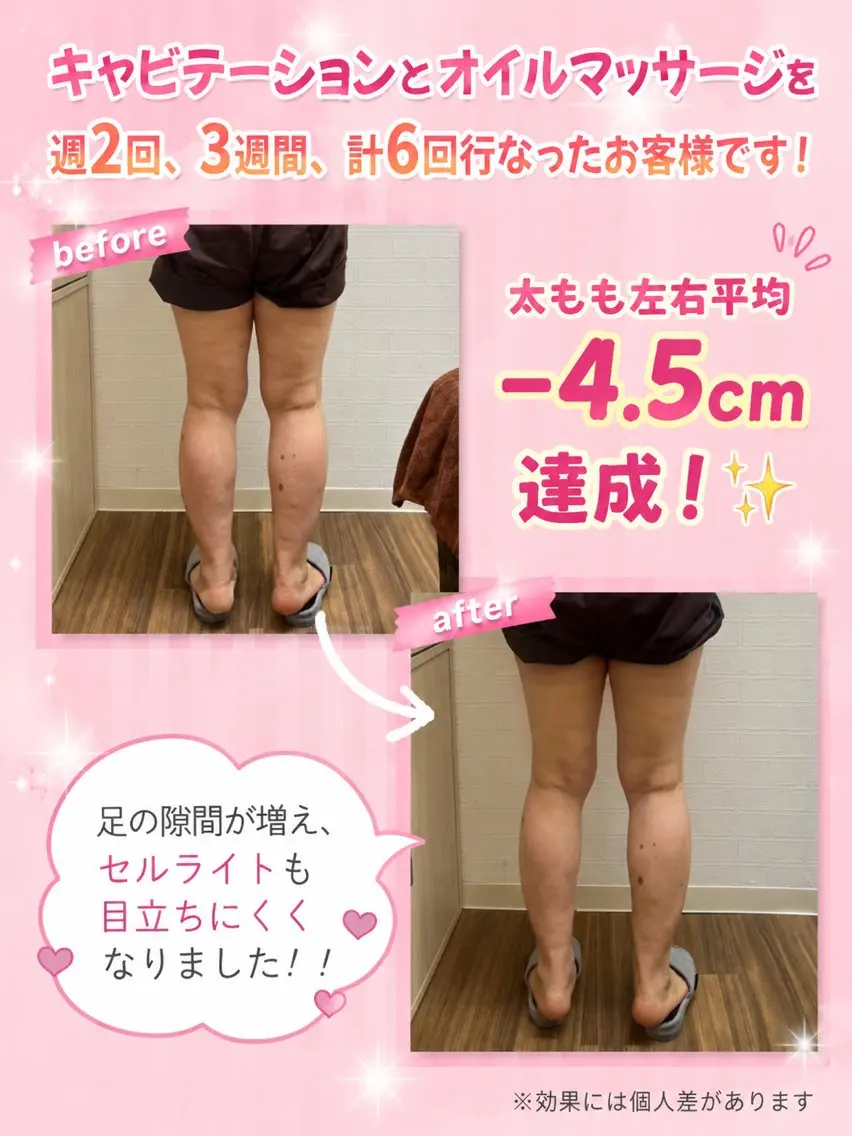 エステ リラク ナチュラル整骨院大山 鈴木琴女のエステ・リラクイメージ