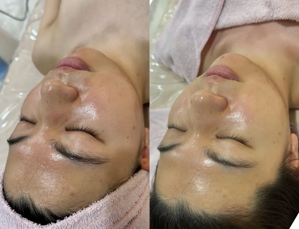 salondeBe 🩵フェイシャル専門のエステ・リラクイメージ