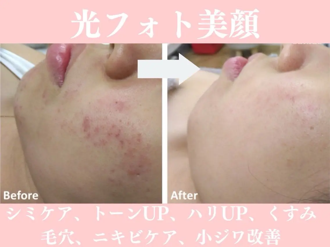 エステ beauty SalonRcoinのマツエク・マツパデザイン