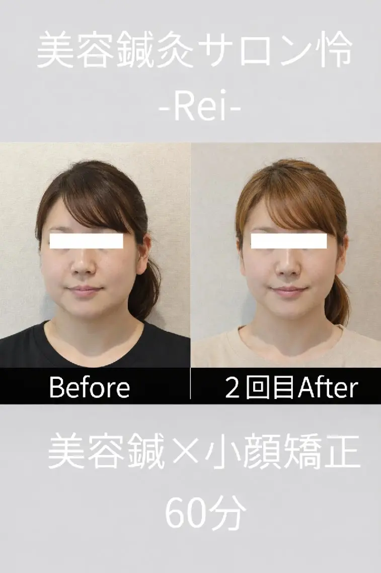 美容鍼灸サロン怜 -Rei-のエステ・リラクイメージ