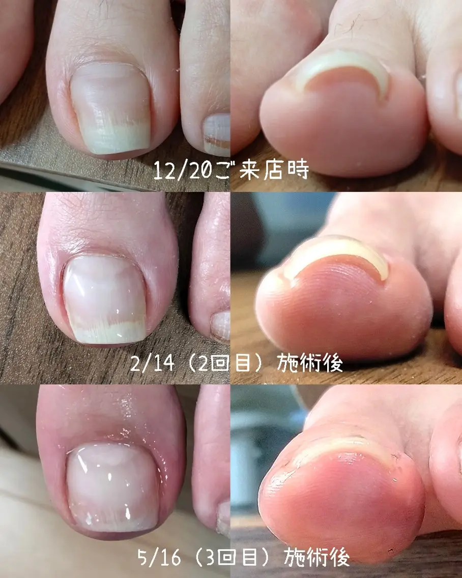 ネイル フットネイル 【まみ】 Ka Pilinaのネイルデザイン