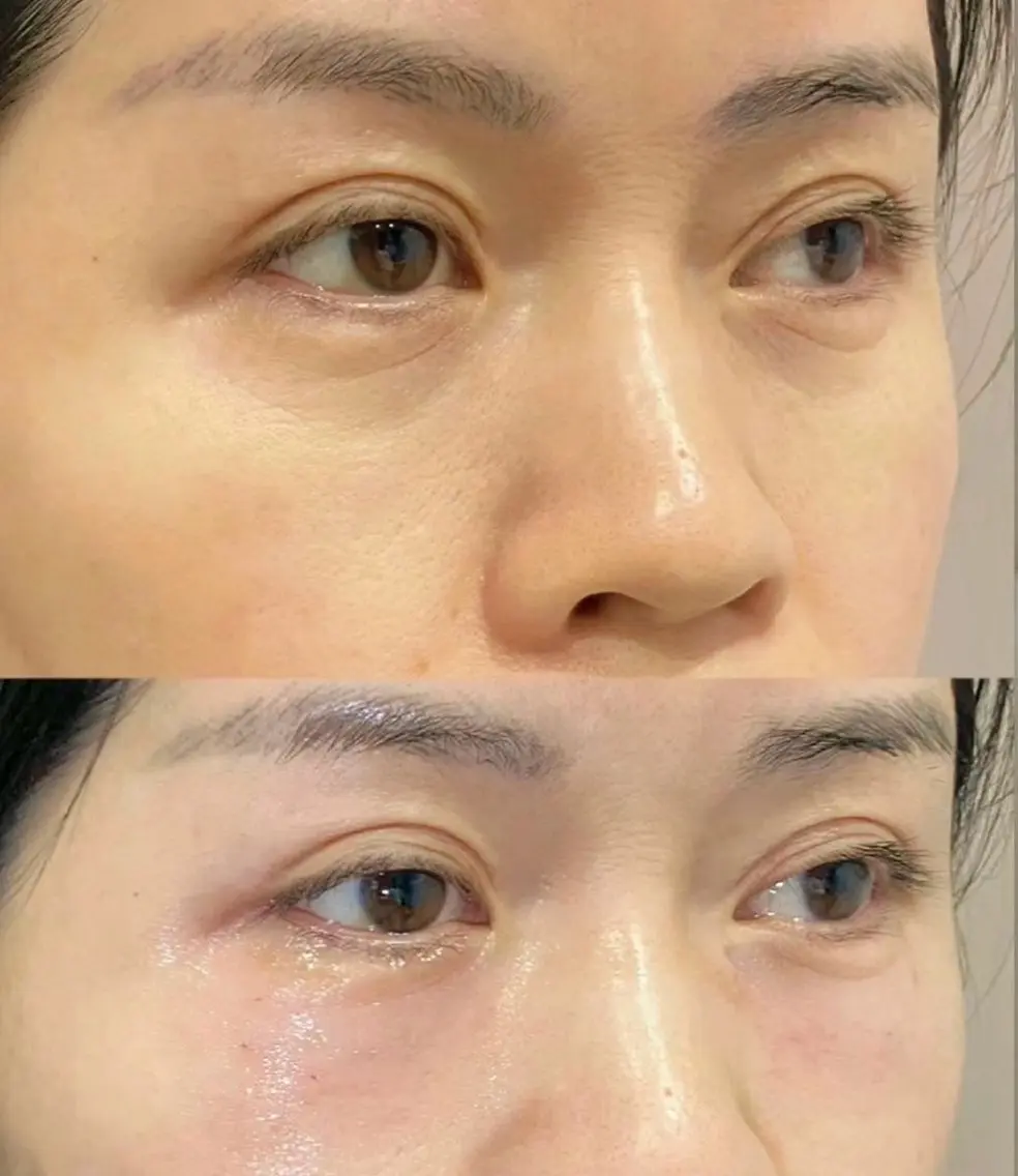 エステ リラク 愛維美水光美肌専門店 メンズレディースokのエステ・リラクイメージ