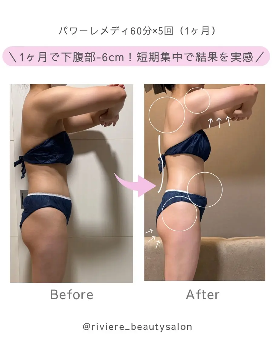 その他 . Reのエステ・リラクイメージ