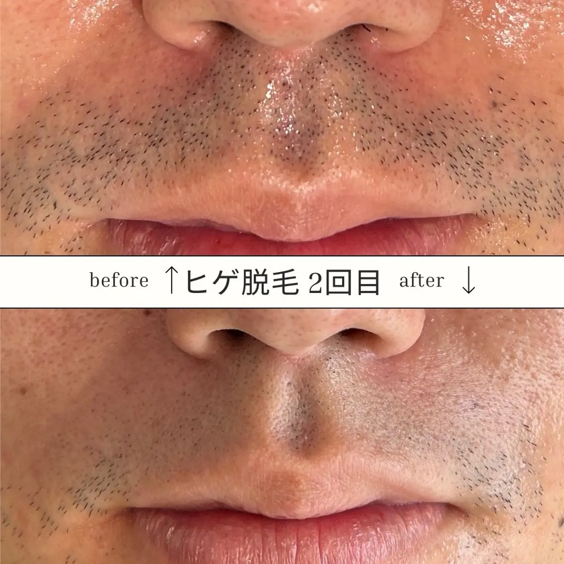 メンズ 脱毛 SKIN GYM メンズ専門脱毛サロンのエステ・リラクイメージ