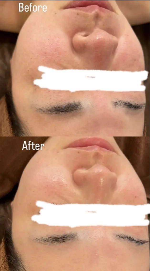 エステ プライベートサロン リプレイスのエステ・リラクイメージ
