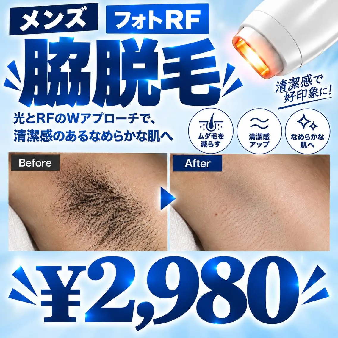 【清潔感UP⤴】匂いケア◎ 脇脱毛 ¥2,980✨の写真
