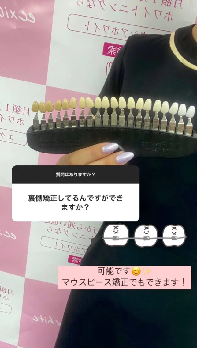 nanami -ホワイトニングのその他イメージ