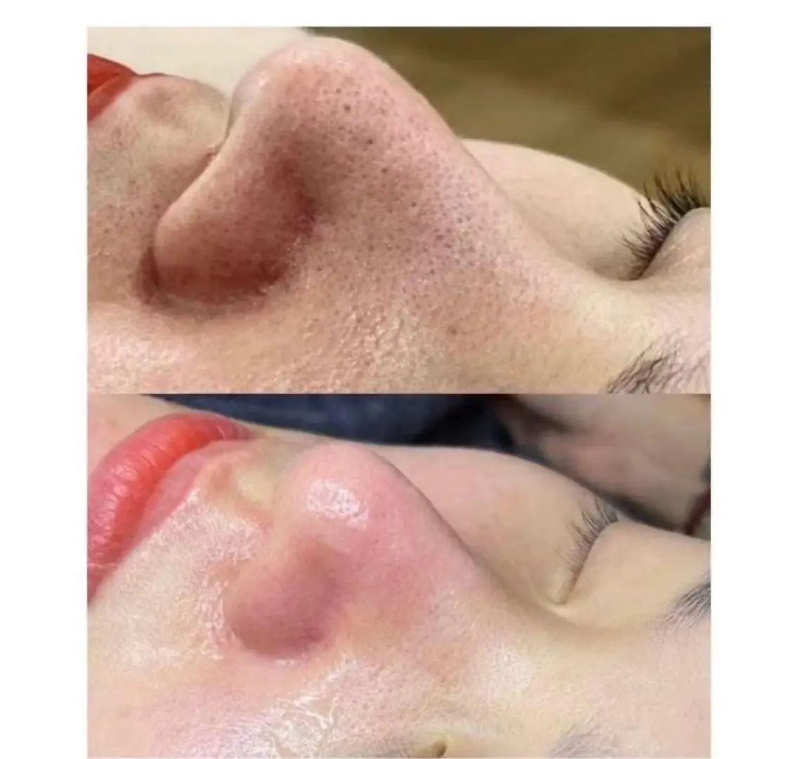 エステ HyHy Spa 新大久保店のエステ・リラクイメージ