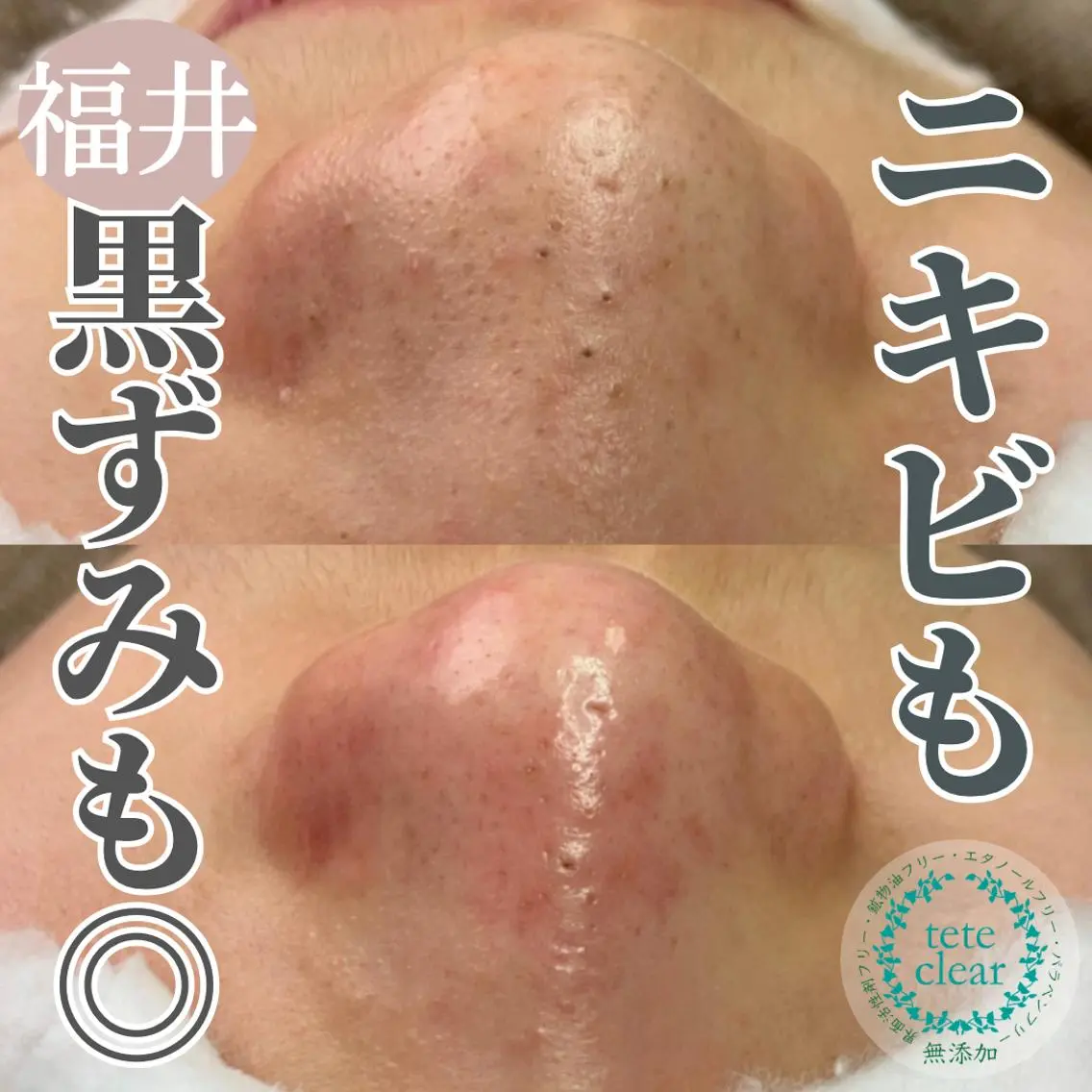 毛穴肌質ケアサロン Yourmeユアミーのエステ・リラクイメージ