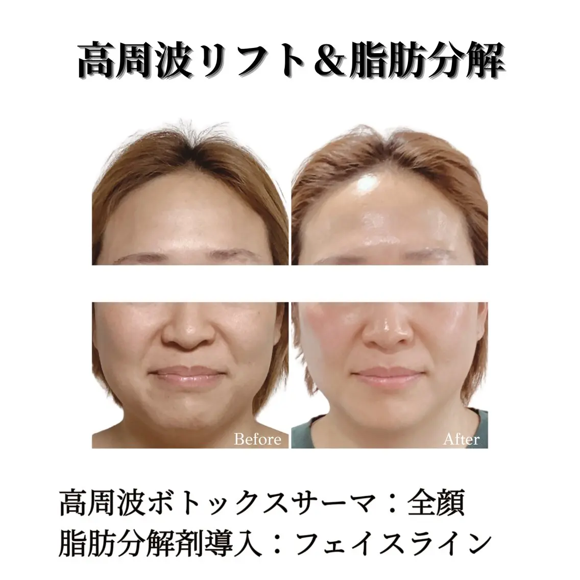 看護師 AYUIのエステ・リラクイメージ